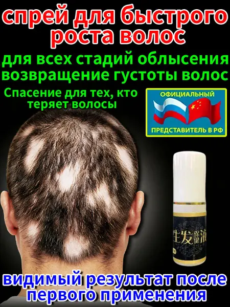 Спрей Чудо Китая Сыворотка спрей для роста волос от выпадения