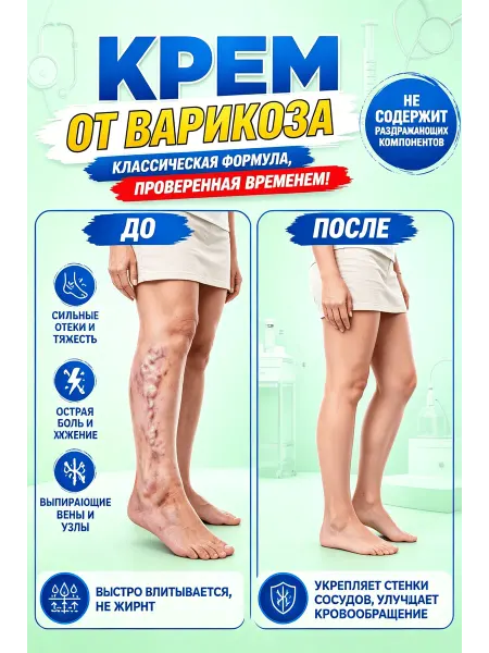 佩措琛克 Монастырский крем для тонуса вен ног