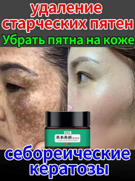 Мази Чудо Китая Увлажняющий крем от пигментации и веснушек для лица