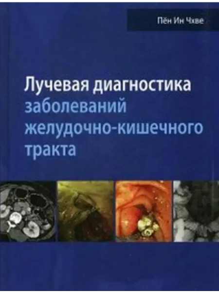 Издательство Панфилова Лучевая диагностика заболеваний желудочно-кишечного тракта