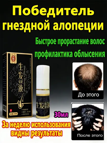 Лосьон от гнездной алопеции