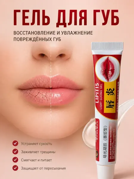 В ТОЧКУ гель для губ при заедах и трещинах заживляющий