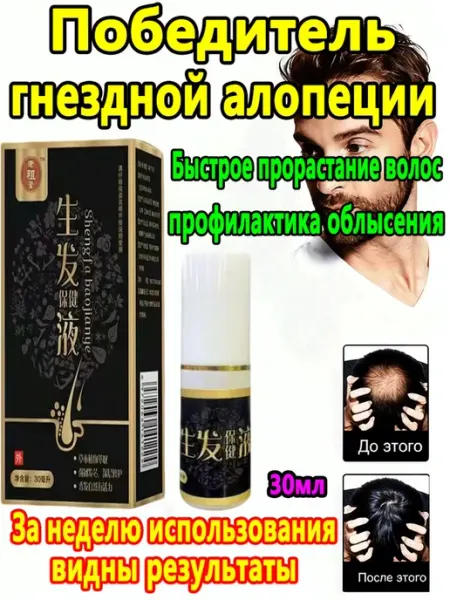 Лосьон от гнездной алопеции