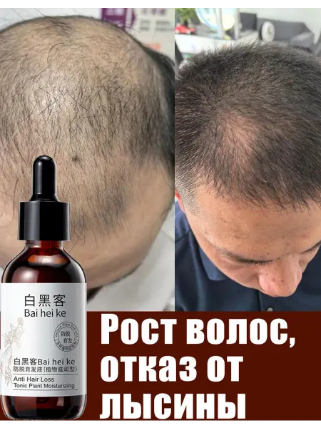 Сыворотка лечебная для роста волос средство от выпадения60мл