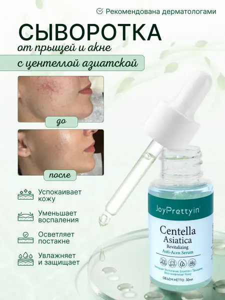 JoyPrettyin Сыворотка для лица от прыщей и постакне с Центелла Азиатская