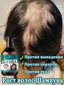 LYDIMOON Японский шампунь , Для роста и объёма волос с экстрактом имбиря. против выпадения волос мужчины и женщины. 500% объёма! 300 мл