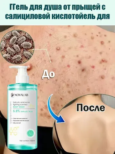 Гель для душа с салициловой кислотой от угревой сыпи, отшелушивания, сужения пор, для жирной и проблемной кожи, 500 мл