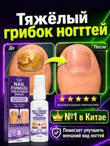 Этот крем для лечения онихомикоза и грибковых инфекций ногтей восстанавливает поврежденные ногти, устраняет желтизну и ломкость, подходит для рук и ног. 30 мл.