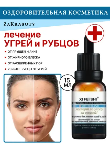 Сыворотка от прыщей, угрей и рубцов ZaKrasoty