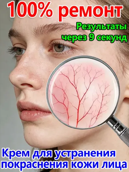Крем для лица Иверлайт против розацеа, 30 гр