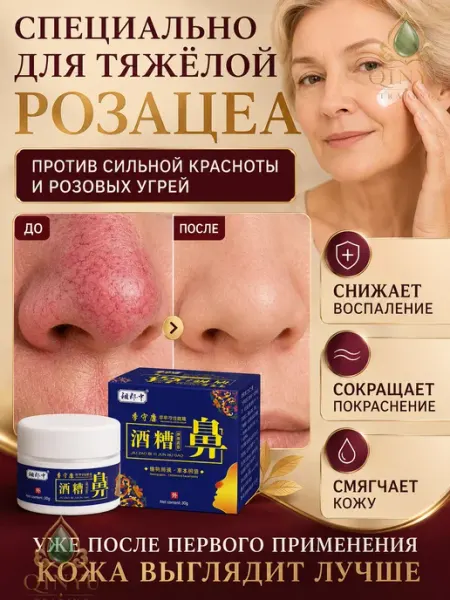 Крем для лица после пилинга и от розацеа Мази Чудо Китая