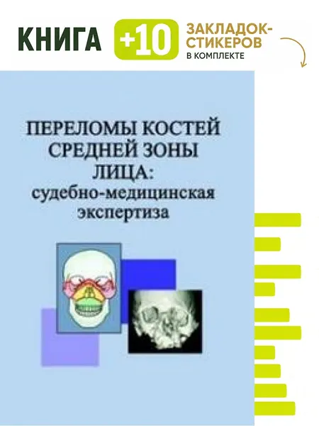 Переломы костей средней зоны лица. Судебно-медицинская экспертиза. Комплект: книга + 10 закладок-стикеров