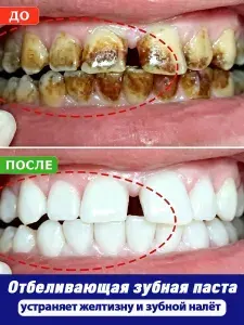 Зубная паста для отбеливания, Удаляет желтые зубы, предотвращает образование зубного камня, зубной налет и пятна от дыма, отбеливание и восстановление эмали