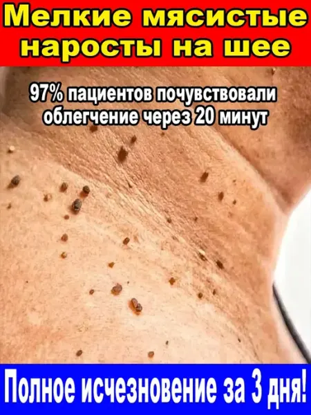 Восстанавливающее травяное мыло от папиллом на лице и шее