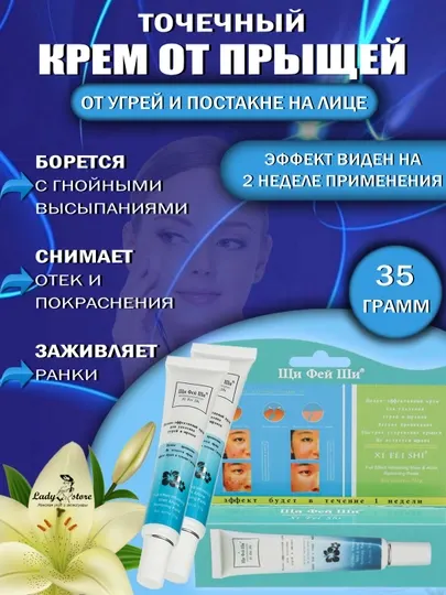 Xi Fei Shi высококачественный крем для удаления прыщей и шрамов от угревой сыпи, 35 гр