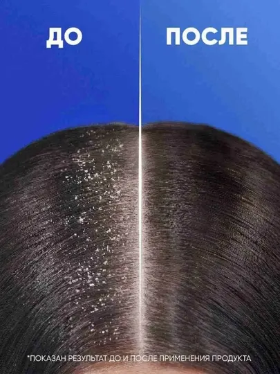 Head & Shoulders Шампунь против перхоти Цитрусовая свежесть 360 мл