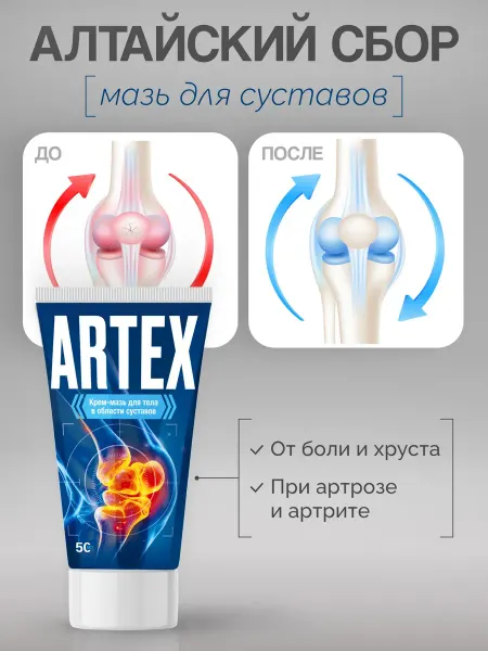 Артекс Мазь для суставов от боли в спине и коленях, обезболивающая