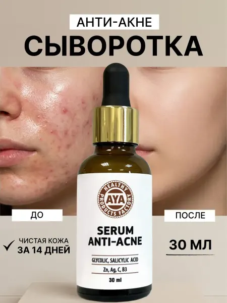 Сыворотка для лица от прыщей и акне