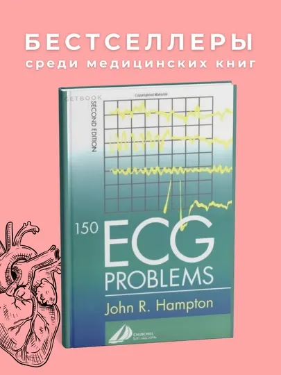 150 ECG problems. Медицина