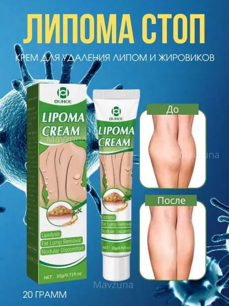 Мазь от липомы и жировиков 20 г