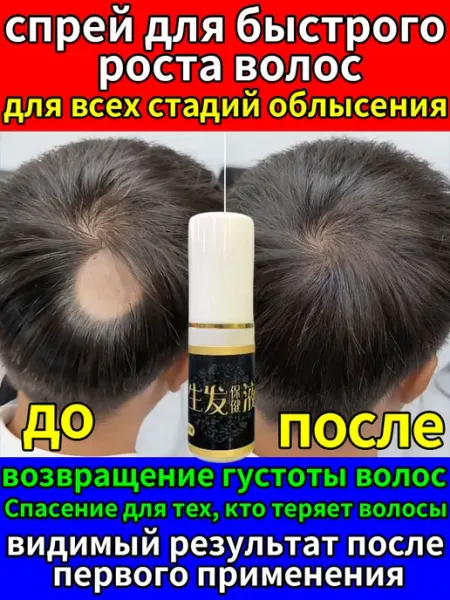 Спрей Чудо Китая Сыворотка для роста волос на голове у мужчин и женщин