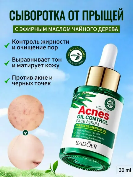 Serum Edge Сыворотка для лица от прыщей и черных точек комедонов акне