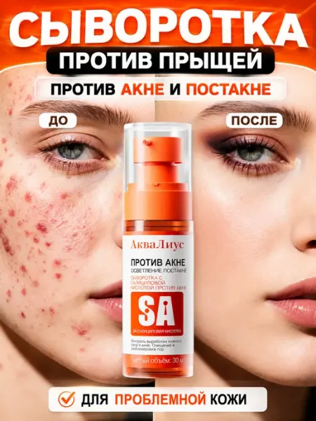 Сыворотка СА от прыщей и постакне, контроль жирности, сужени…