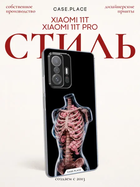 Case Place Чехол на Xiaomi Mi 11T Xiaomi Mi 11T Pro пинтерест