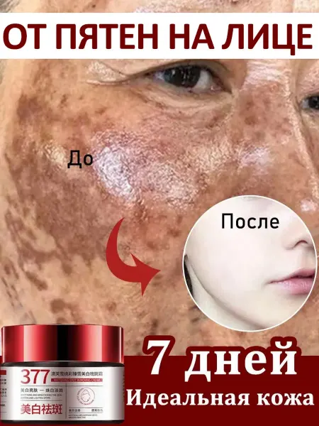 Крем для лица, aнтивозрастной, от пигментных пятен