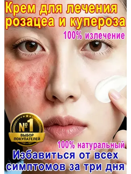 Успокаивающий крем для лица от покраснений, против купероза