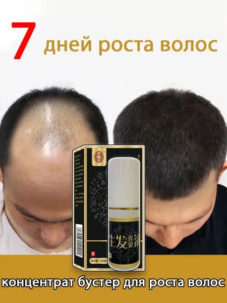 Сыворотка - спрей ативатор роста волос
