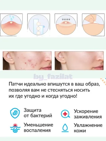 Точечные патчи-пластыри-наклейки от прыщей, акне и черных точек, 40 наклеек