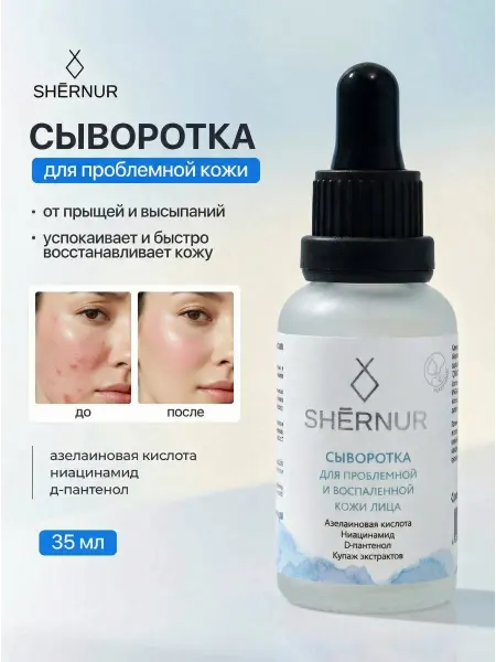 Shernur Сыворотка для лица против прыщeй и акне с ниацинамидом
